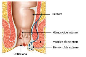 Anatomie Hémorroïdes